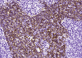 Cytokeratin 5 Recombinant Rabbit Monoclonal Antibody