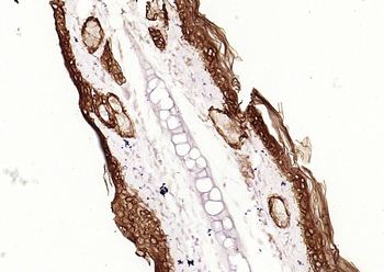 Cytokeratin 5 Recombinant Rabbit Monoclonal Antibody