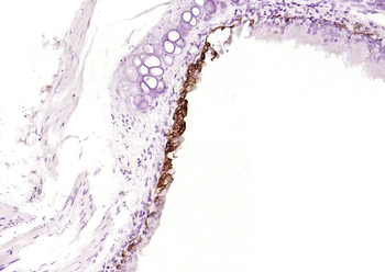 Cytokeratin 5 Recombinant Rabbit Monoclonal Antibody