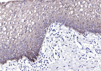 Cytokeratin 4 Recombinant Rabbit Monoclonal Antibody