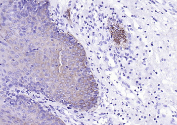 Cytokeratin 4 Recombinant Rabbit Monoclonal Antibody