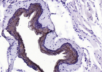 Cytokeratin 4 Recombinant Rabbit Monoclonal Antibody