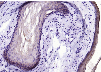 Cytokeratin 4 Recombinant Rabbit Monoclonal Antibody