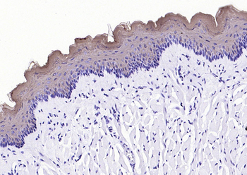 Cytokeratin 4 Recombinant Rabbit Monoclonal Antibody