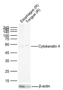 Cytokeratin 4 Recombinant Rabbit Monoclonal Antibody