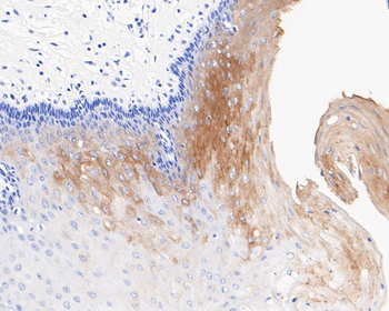 Cytokeratin 2e Recombinant Rabbit Monoclonal Antibody