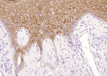 Cytokeratin 2e Recombinant Rabbit Monoclonal Antibody