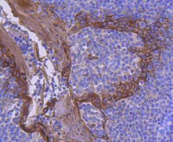 Cytokeratin 2e Recombinant Rabbit Monoclonal Antibody