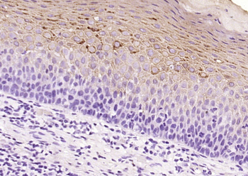 Cytokeratin 2e Recombinant Rabbit Monoclonal Antibody
