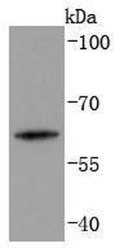 Cytokeratin 2e Recombinant Rabbit Monoclonal Antibody