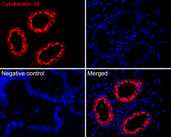 Cytokeratin 16 Recombinant Rabbit Monoclonal Antibody