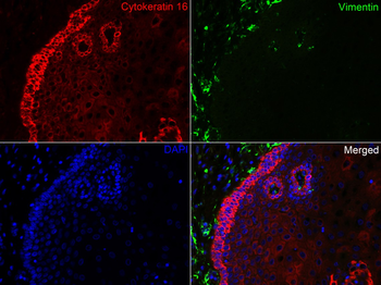Cytokeratin 16 Recombinant Rabbit Monoclonal Antibody