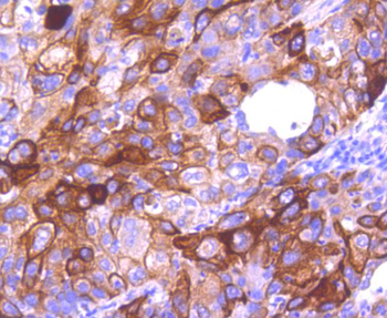 Cytokeratin 16 Recombinant Rabbit Monoclonal Antibody