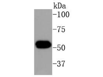 Cytokeratin 16 Recombinant Rabbit Monoclonal Antibody