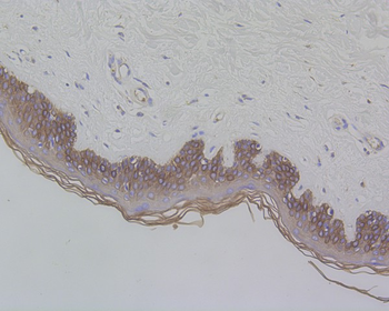 Cytokeratin 17 Recombinant Rabbit Monoclonal Antibody
