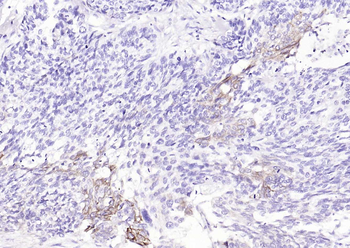 Cytokeratin 14 Recombinant Rabbit Monoclonal Antibody