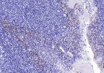 Cytokeratin 14 Recombinant Rabbit Monoclonal Antibody