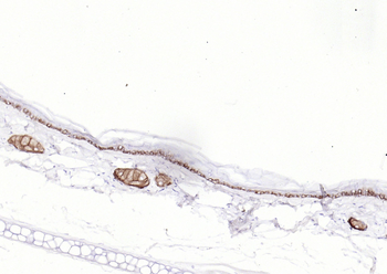 Cytokeratin 14 Recombinant Rabbit Monoclonal Antibody