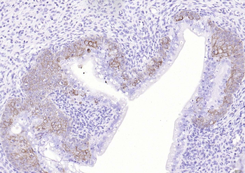 Cytokeratin 14 Recombinant Rabbit Monoclonal Antibody