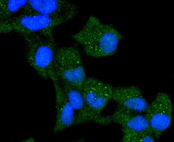 Cytokeratin 13 Recombinant Rabbit Monoclonal Antibody