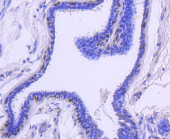 Cytokeratin 13 Recombinant Rabbit Monoclonal Antibody
