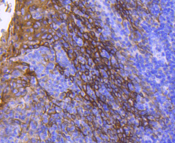 Cytokeratin 13 Recombinant Rabbit Monoclonal Antibody