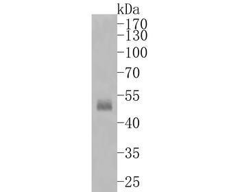 Cytokeratin 13 Recombinant Rabbit Monoclonal Antibody