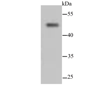 Cytokeratin 13 Recombinant Rabbit Monoclonal Antibody