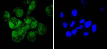 Cyclin E2 Recombinant Rabbit Monoclonal Antibody