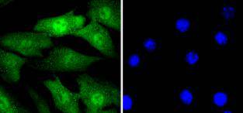 Cyclin E2 Recombinant Rabbit Monoclonal Antibody