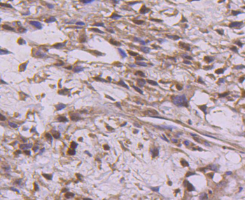 Cyclin E2 Recombinant Rabbit Monoclonal Antibody