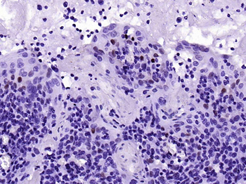 Cyclin D1 Recombinant Rabbit Monoclonal Antibody