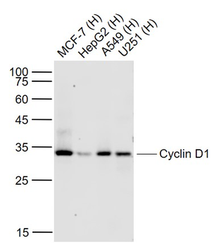 Cyclin D1 Recombinant Rabbit Monoclonal Antibody