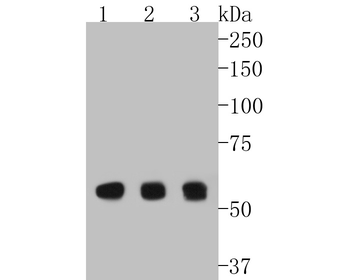 Cyclin B1 Recombinant Rabbit Monoclonal Antibody