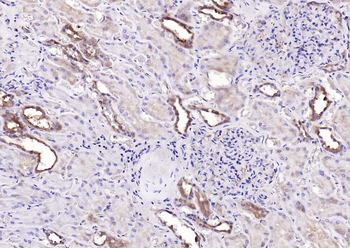 IRF6 Recombinant Rabbit Monoclonal Antibody