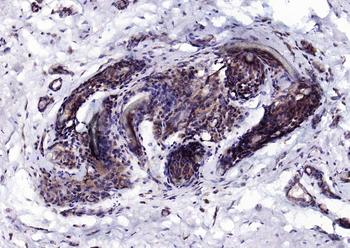 IRF6 Recombinant Rabbit Monoclonal Antibody