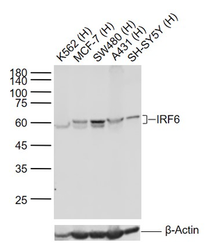 IRF6 Recombinant Rabbit Monoclonal Antibody