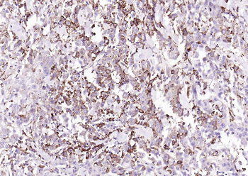 IRF5 Recombinant Rabbit Monoclonal Antibody