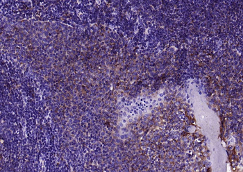 IRF5 Recombinant Rabbit Monoclonal Antibody