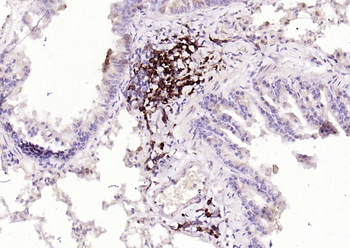 IRF5 Recombinant Rabbit Monoclonal Antibody