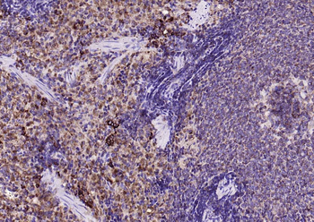 IRF5 Recombinant Rabbit Monoclonal Antibody