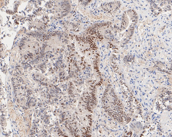 IRF1 Recombinant Rabbit Monoclonal Antibody