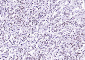 Histone H2A.Z Recombinant Rabbit Monoclonal Antibody