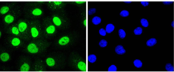 HDAC8 Recombinant Rabbit Monoclonal Antibody