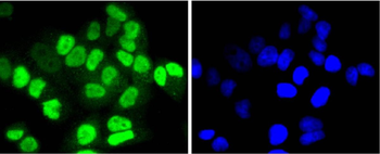 HDAC8 Recombinant Rabbit Monoclonal Antibody