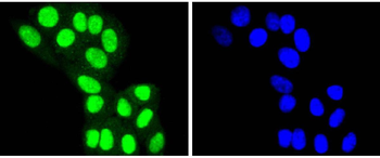HDAC8 Recombinant Rabbit Monoclonal Antibody