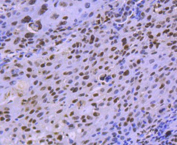 HDAC8 Recombinant Rabbit Monoclonal Antibody