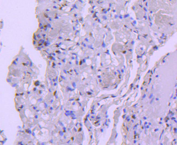 HDAC8 Recombinant Rabbit Monoclonal Antibody
