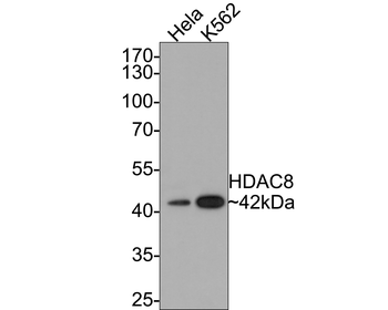 HDAC8 Recombinant Rabbit Monoclonal Antibody