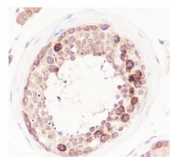 HDAC6 Recombinant Rabbit Monoclonal Antibody